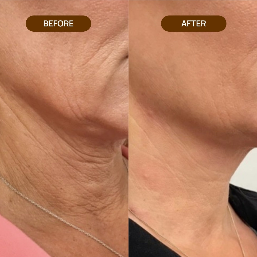 AH-8 Neck Firming Cream